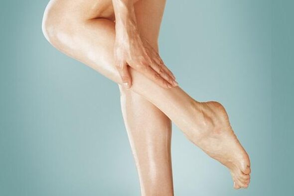 varicose veins