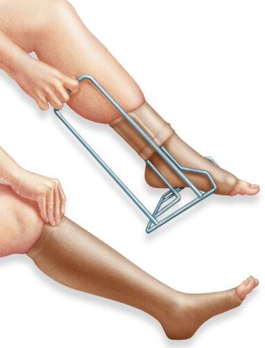 Compression therapy