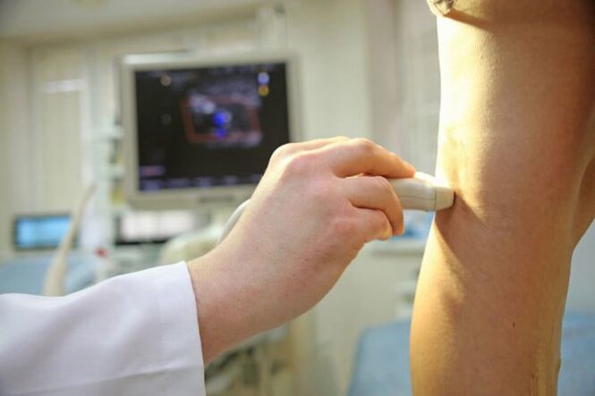 Ultrasound of the veins